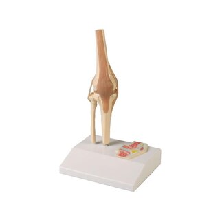 Articulação do joelho em miniatura com secção transversal