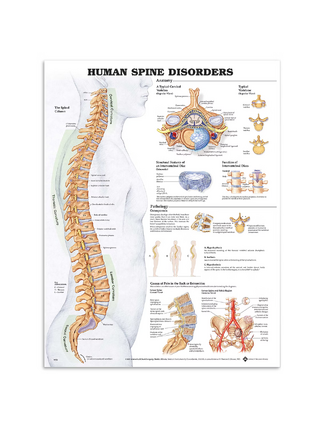 Cartaz sobre doenças da coluna vertebral em filme plástico PET de alto brilho (Doenças da coluna vertebral humana)