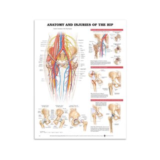 Pôster - Anatomia e lesões da articulação do quadril em inglês