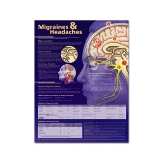 Poster didático Enxaqueca e cefaleia, plastificado 51x66 cm (em inglês)