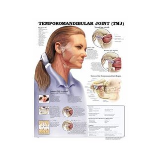 Disfunção da articulação temporomandibular (ATM) laminada Inglês