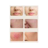 Máscara de luz vermelha LED 4D - Máscara facial